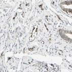 Anti-TAPBP Antibody