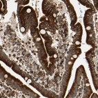 Immunohistochemical staining of human duodenum shows strong positivity in endoplasmic reticulum in glandular cells.