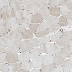 Immunohistochemical staining of human skeletal muscle shows very weak positivity in endoplasmic reticulum in myocytes.