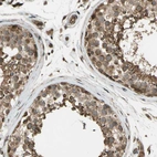 Immunohistochemical staining of human testis shows strong cytoplasmic positivity in cells in seminiferous ducts.