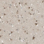 Immunohistochemical staining of human cerebral cortex shows moderate cytoplasmic positivity in neurons.