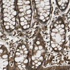 Immunohistochemical staining of human gastrointestinal shows strong cytoplasmic positivity in glandular cells.