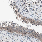 Anti-RAD54B Antibody