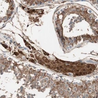 Immunohistochemical staining of human testis shows strong cytoplasmic positivity in Leydig cells and cells in seminiferous ducts.