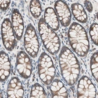 Immunohistochemical staining of human colon shows moderate cytoplasmic positivity in glandular cells.