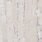 Immunohistochemical staining of human skeletal muscle shows no positivity in myocytes as expected.