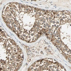 Immunohistochemical staining of human testis shows moderate cytoplasmic positivity in cells in seminiferous ducts.