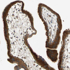 Immunohistochemical staining of human placenta shows strong cytoplasmic positivity in trophoblastic cells.