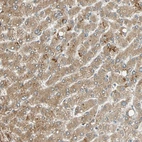 Immunohistochemical staining of human liver shows moderate cytoplasmic positivity in hepatocytes.