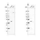 Western blot analysis using Anti-GALK1 antibody HPA007094 (A) shows similar pattern to independent antibody HPA016960 (B).