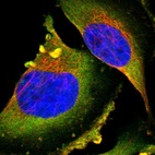 Anti-PTPN12 Antibody