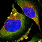 Immunofluorescent staining of human cell line U-251 MG shows positivity in plasma membrane & cytoplasm.