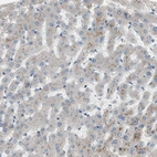 Immunohistochemical staining of human liver shows weak membranous positivity in hepatocytes.