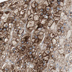 Immunohistochemical staining of human adrenal gland shows strong membranous positivity in glandular cells.
