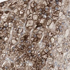 Immunohistochemical staining of human adrenal gland shows strong membranous positivity in glandular cells.