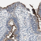 Immunohistochemical staining of human endometrium shows strong positivity in apical membrane in glandular cells.