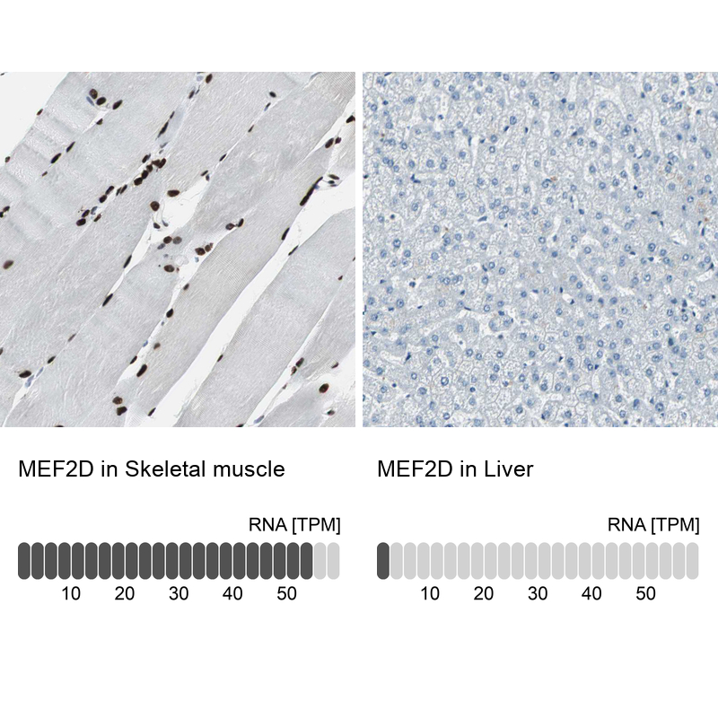 Anti-MEF2D Antibody
