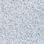 Immunohistochemical staining of human liver shows no positivity in hepatocytes as expected.