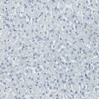 Immunohistochemical staining of human liver shows no positivity in hepatocytes as expected.