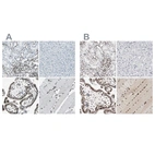 Immunohistochemical staining of human kidney, liver, placenta and skeletal muscle using Anti-MEF2D antibody HPA007114 (A) shows similar protein distribution across tissues to independent antibody HPA004807 (B).