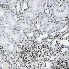 Immunohistochemical staining of human kidney shows strong nuclear positivity in cells in glomeruli.