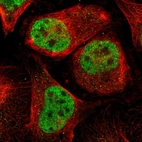 Immunofluorescent staining of human cell line U-2 OS shows localization to nucleoplasm.