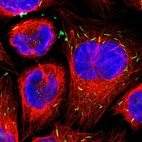 Immunofluorescent staining of human cell line U-2 OS shows localization to rods & rings.