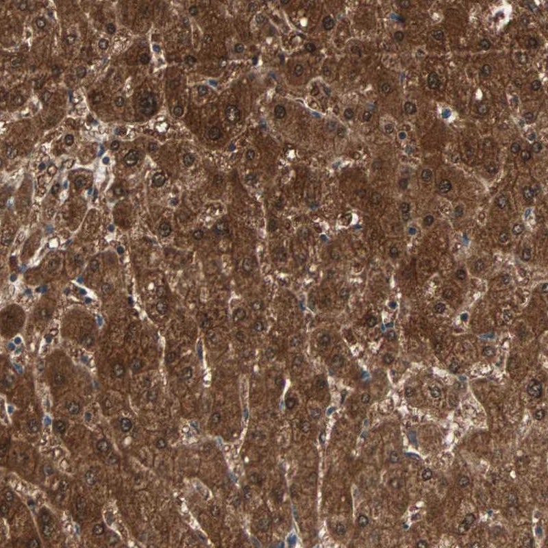Anti-ZSCAN31 Antibody