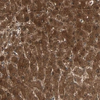 Anti-ZSCAN31 Antibody