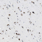 Anti-ADNP2 Antibody