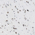 Anti-ADNP2 Antibody