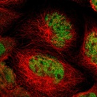 Immunofluorescent staining of human cell line A-431 shows localization to nucleus.