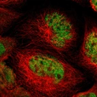 Immunofluorescent staining of human cell line A-431 shows localization to nucleus.