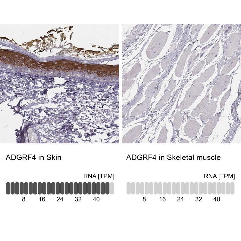 Anti-ADGRF4 Antibody