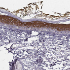 Immunohistochemical staining of human skin shows strong cytoplasmic positivity in keratinocytes.