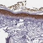 Immunohistochemical staining of human skin shows strong cytoplasmic positivity in keratinocytes.