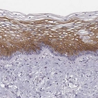 Immunohistochemical staining of human cervix, uterine shows moderate to strong cytoplasmic positivity in squamous epithelial cells.