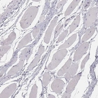 Immunohistochemical staining of human skeletal muscle shows no positivity in myocytes as expected.