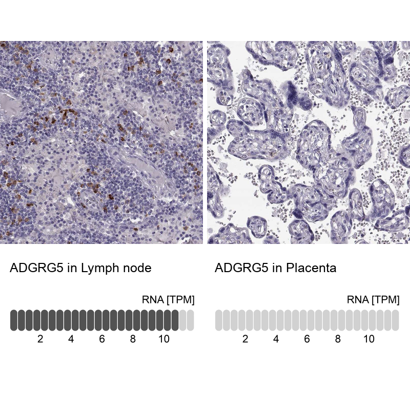 Anti-ADGRG5 Antibody