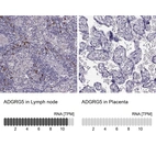 Anti-ADGRG5 Antibody