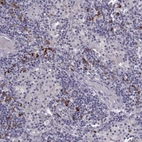 Immunohistochemical staining of human lymph node shows high expression.