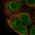 Immunofluorescent staining of human cell line CACO-2 shows localization to nucleoplasm, nuclear membrane & vesicles.