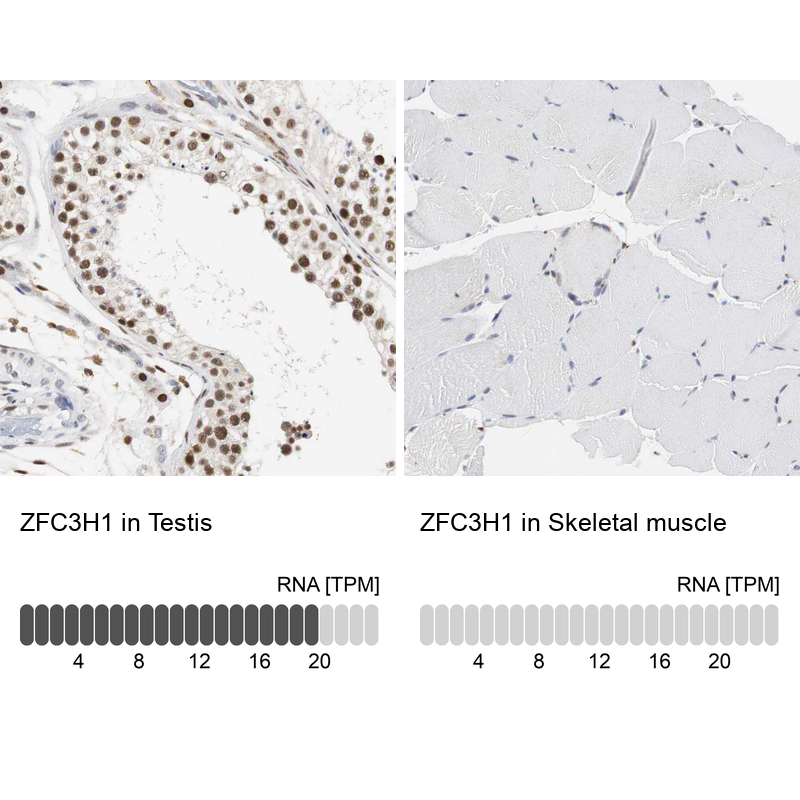 Anti-ZFC3H1 Antibody