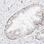 Immunohistochemical staining of human prostate shows strong nuclear positivity in glandular cells.