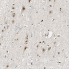 Immunohistochemical staining of human cerebral cortex shows moderate positivity in neurons.