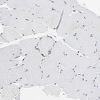 Immunohistochemical staining of human skeletal muscle shows no positivity in myocytes as expected.