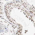 Immunohistochemical staining of human testis shows strong nuclear positivity in cells in seminiferous ducts.