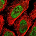 Immunofluorescent staining of human cell line U-2 OS shows localization to nucleoplasm.