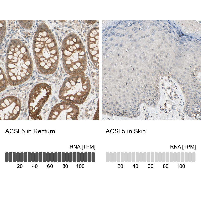Anti-ACSL5 Antibody