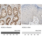Anti-ACSL5 Antibody